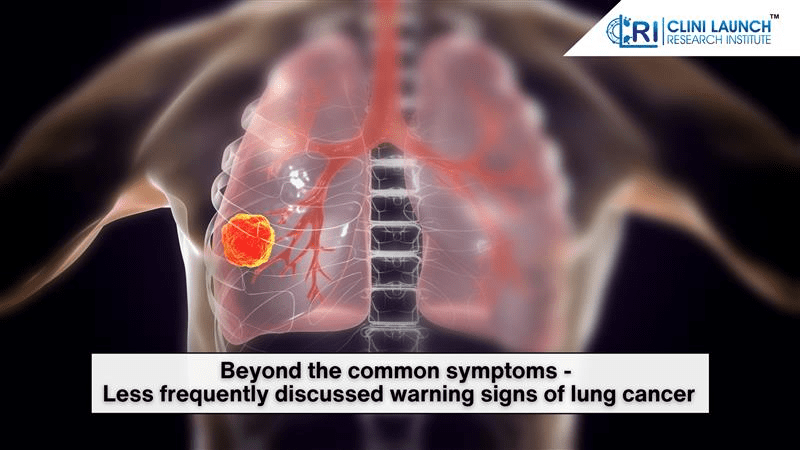 Beyond the common symptoms - Less frequently discussed warning signs of lung cancer